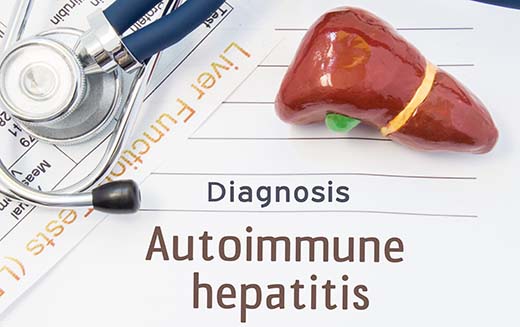 6 Must-Know Facts About Autoimmune Hepatitis