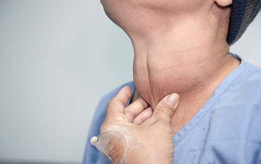 7 Grave's Disease Facts You Must Know About